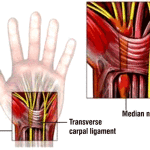 carpal picture